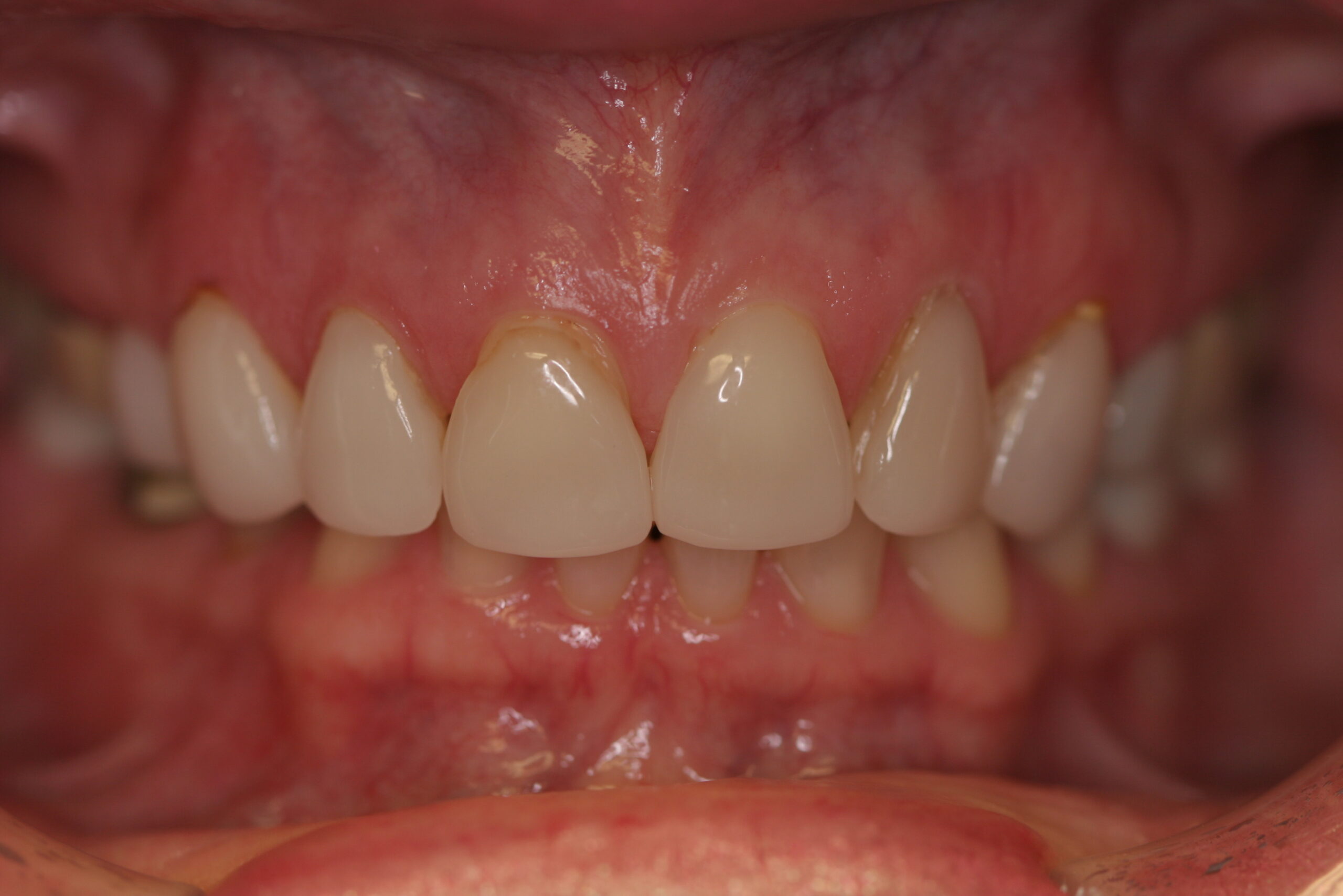 Before image