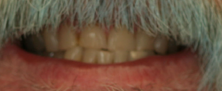 Before image
